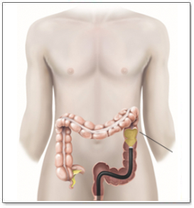 colonoscopia